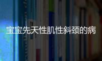 宝宝先天性肌性斜颈的病因